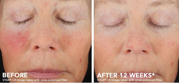    Revision Skincare C+ Correcting Complex 30% 30ml
