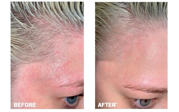    Revision Skincare C+ Correcting Complex 30% 30ml